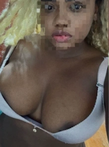 Miel, kinesiólogas en Tacna 928680203